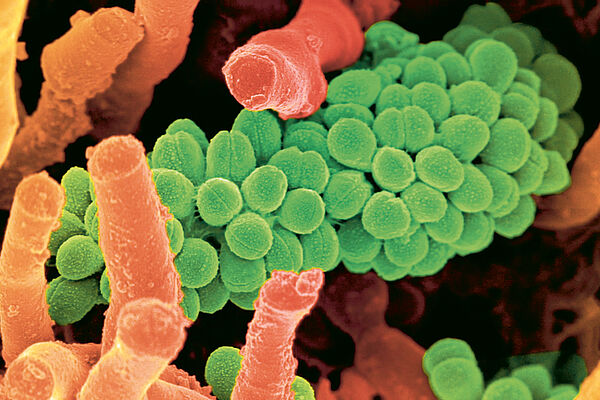 Two types of soil bacteria, strongly magnified.